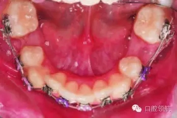 640.webp (8).jpg 640.webp (8).jpg