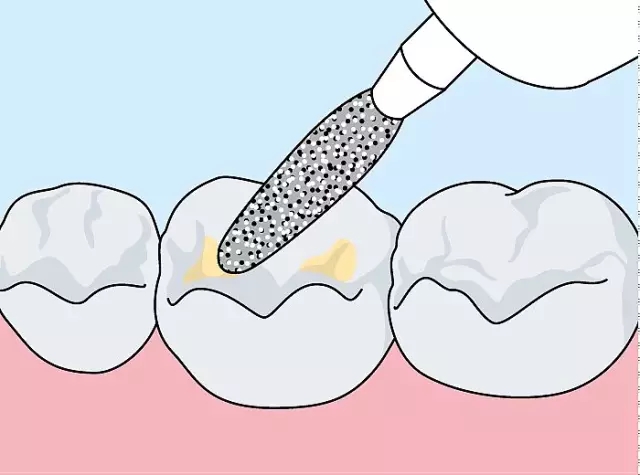 640.webp (5).jpg 640.webp (5).jpg