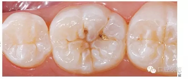 640.webp.jpg 640.webp.jpg