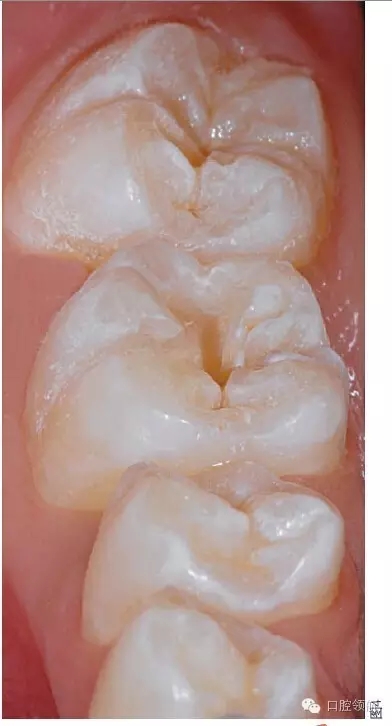 640.webp (2).jpg 640.webp (2).jpg