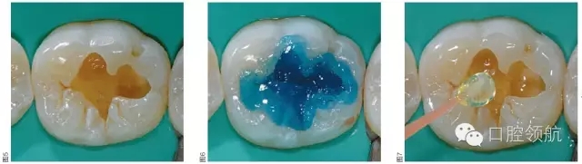 640.webp (3).jpg 640.webp (3).jpg