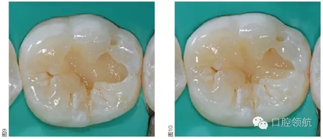 640.webp (5).jpg 640.webp (5).jpg