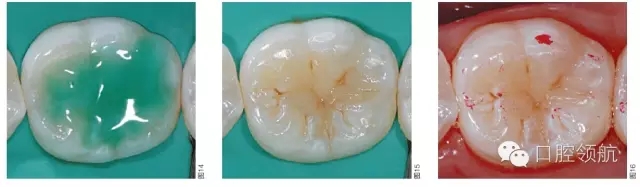 640.webp (7).jpg 640.webp (7).jpg