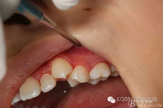 640.webp.jpg 640.webp.jpg