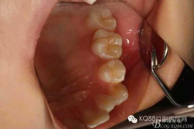 640.webp (1).jpg 640.webp (1).jpg