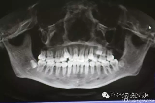 640.webp (2).jpg 640.webp (2).jpg