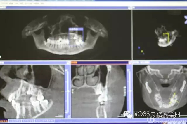 640.webp (3).jpg 640.webp (3).jpg