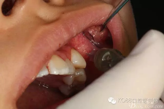 640.webp (4).jpg 640.webp (4).jpg