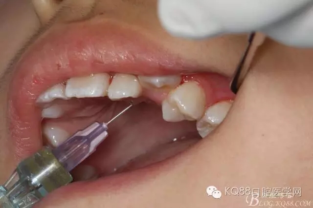 640.webp (5).jpg 640.webp (5).jpg