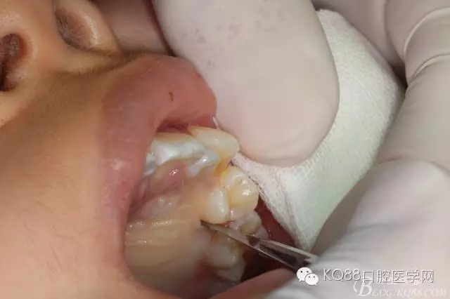 640.webp (6).jpg 640.webp (6).jpg