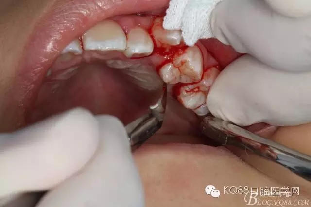 640.webp (7).jpg 640.webp (7).jpg