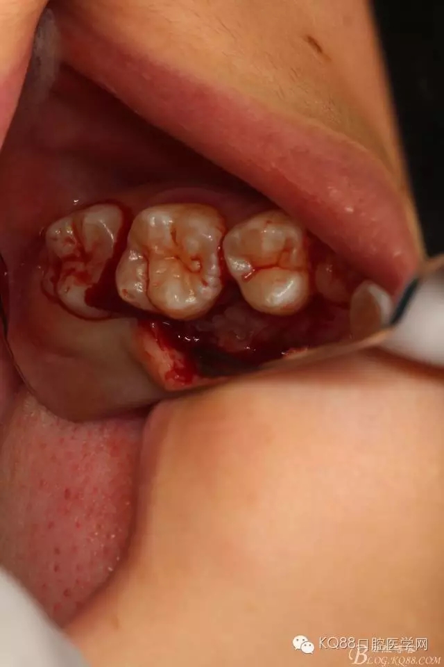 640.webp (9).jpg 640.webp (9).jpg