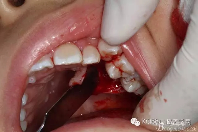 640.webp (10).jpg 640.webp (10).jpg