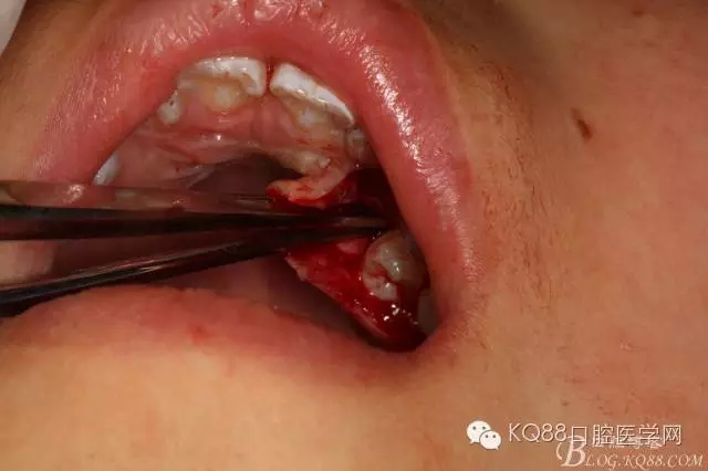 640.webp (11).jpg 640.webp (11).jpg