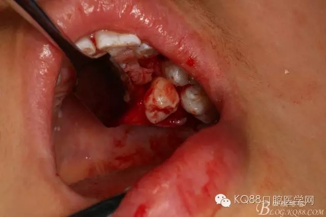 640.webp (12).jpg 640.webp (12).jpg