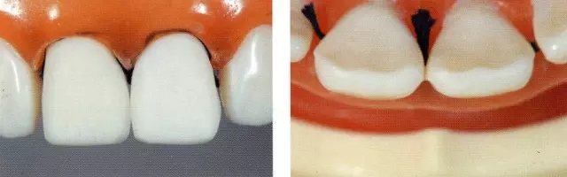 640.webp (9).jpg 640.webp (9).jpg