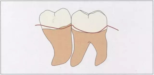 640.webp.jpg 640.webp.jpg