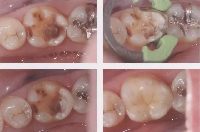 640.webp (3).jpg 640.webp (3).jpg