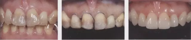 640.webp (4).jpg 640.webp (4).jpg