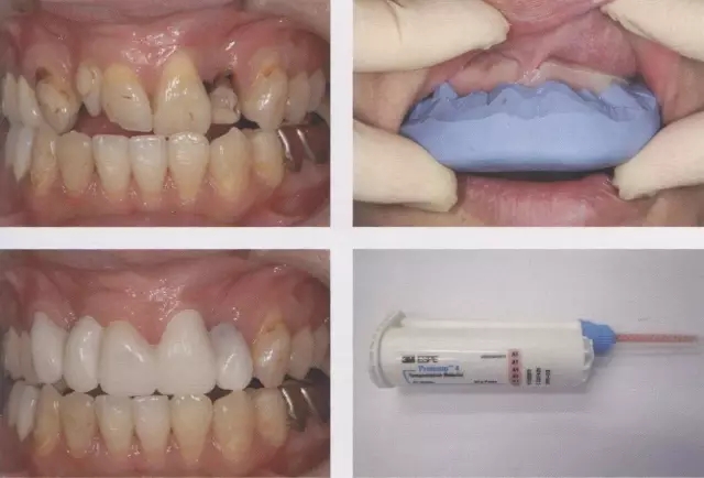 640.webp (1).jpg 640.webp (1).jpg