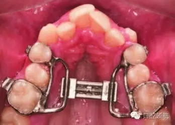 640.webp (14).jpg 640.webp (14).jpg