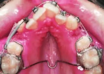 640.webp (15).jpg 640.webp (15).jpg