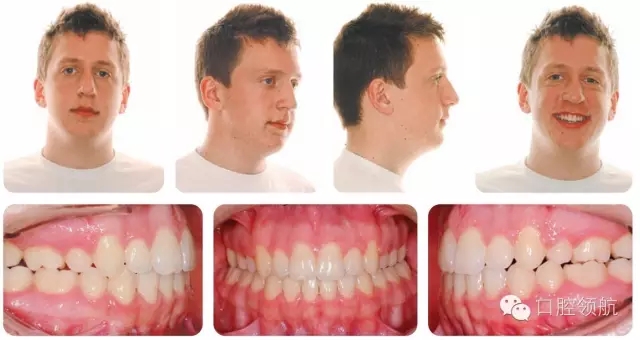 640.webp (16).jpg 640.webp (16).jpg