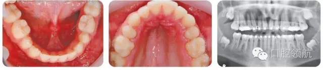 640.webp (17).jpg 640.webp (17).jpg