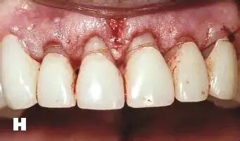 640 (1).webp (1).jpg 640 (1).webp (1).jpg