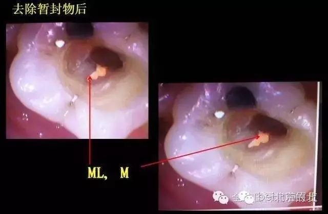 640.webp (11).jpg 640.webp (11).jpg