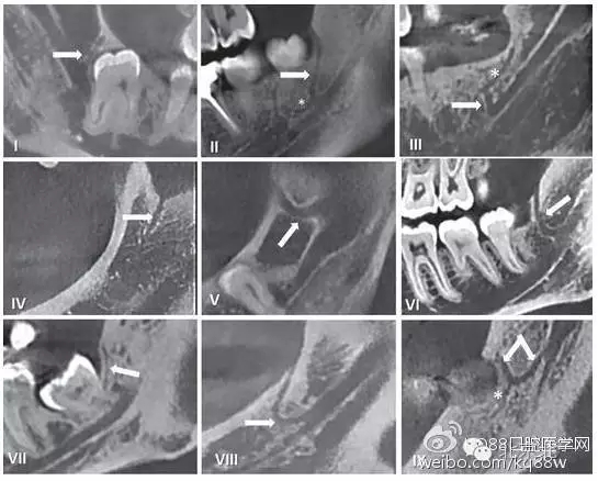 640.webp (4).jpg 640.webp (4).jpg