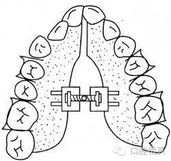 640.webp (11).jpg 640.webp (11).jpg