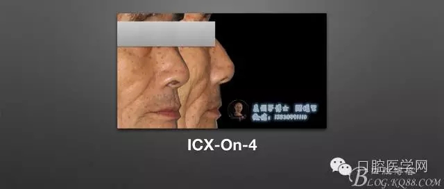 640.webp.jpg 640.webp.jpg