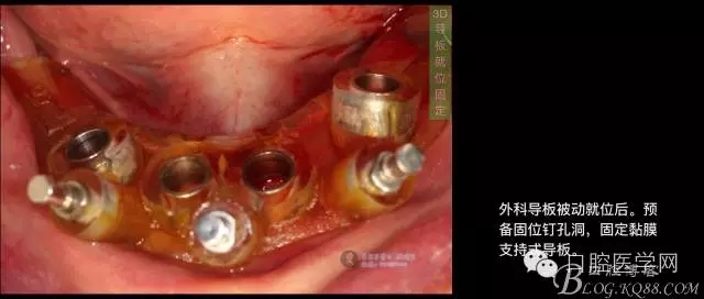 640.webp (9).jpg 640.webp (9).jpg