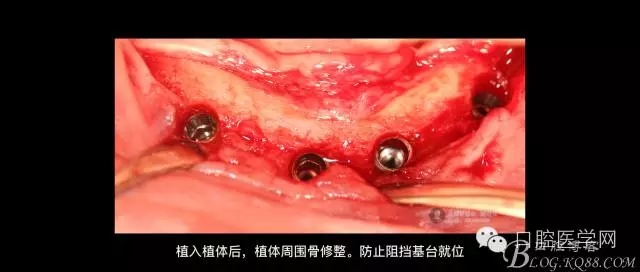 640.webp (10).jpg 640.webp (10).jpg