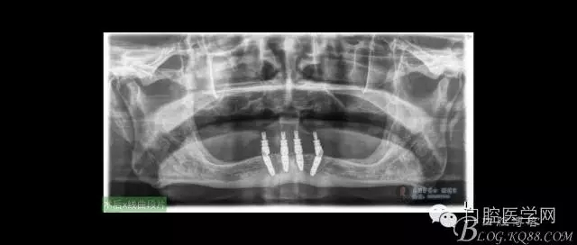 640.webp (13).jpg 640.webp (13).jpg