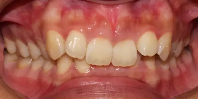 640.webp (5).jpg 640.webp (5).jpg