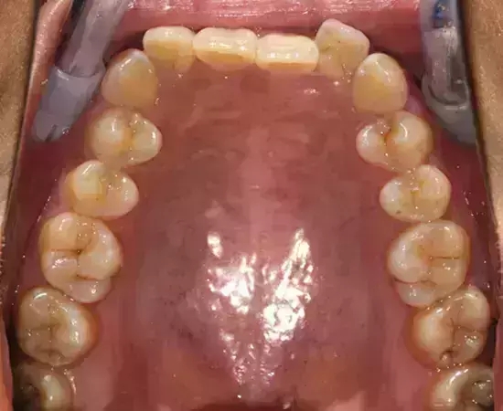 640.webp (7).jpg 640.webp (7).jpg