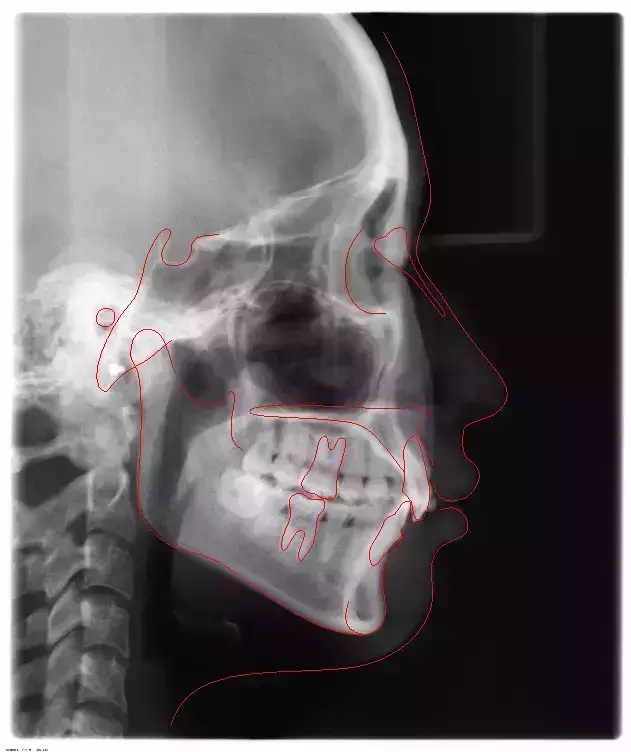 640.webp (11).jpg 640.webp (11).jpg