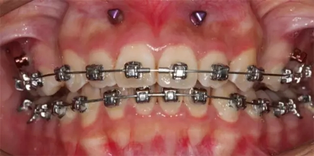 640.webp (17).jpg 640.webp (17).jpg