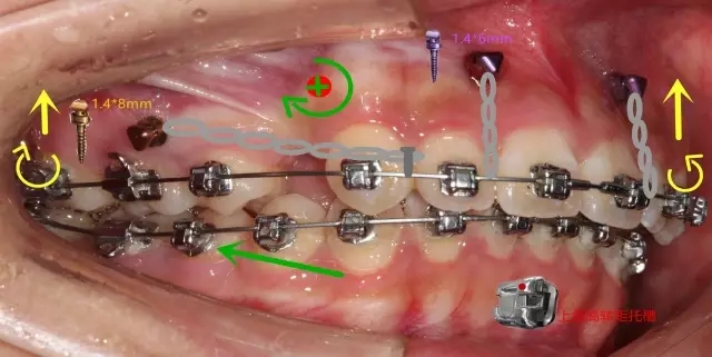 640.webp (21).jpg 640.webp (21).jpg