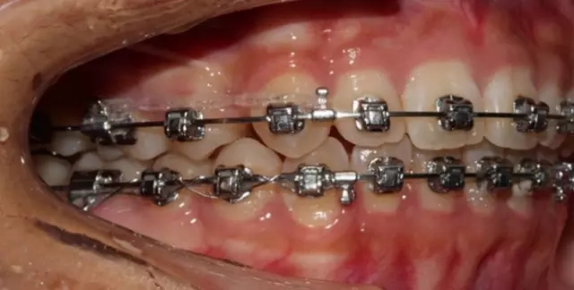 640.webp (22).jpg 640.webp (22).jpg