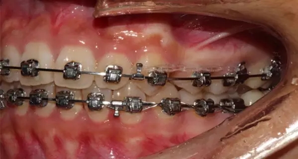 640.webp (24).jpg 640.webp (24).jpg