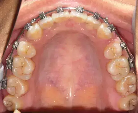 640.webp (25).jpg 640.webp (25).jpg