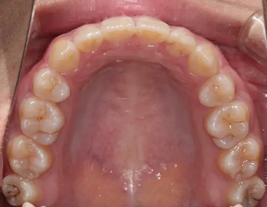 640.webp (50).jpg 640.webp (50).jpg