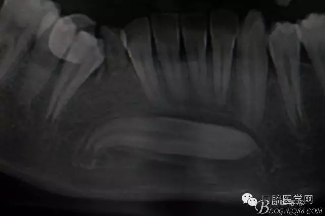 640.webp.jpg 640.webp.jpg