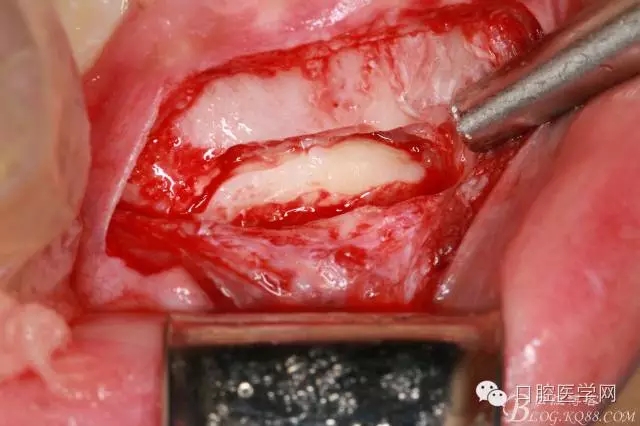 640.webp (4).jpg 640.webp (4).jpg