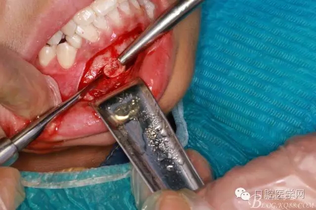 640.webp (7).jpg 640.webp (7).jpg