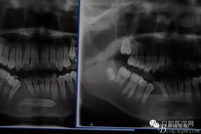 640.webp (9).jpg 640.webp (9).jpg