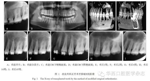 640.webp (2).jpg 640.webp (2).jpg